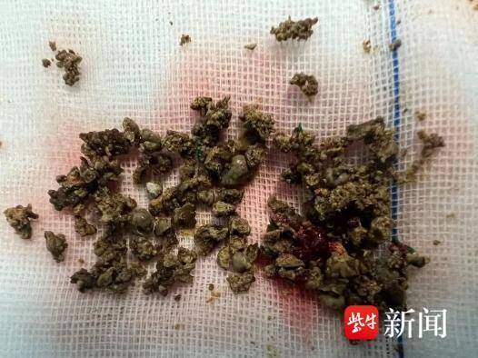 新澳天天开奖资料大全最新54期,中新真探：月经来7天比来3天更健康？